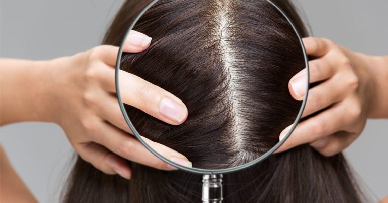 Why Scalp Care Has Moved From Afterthought to Recognised Wellness Category
