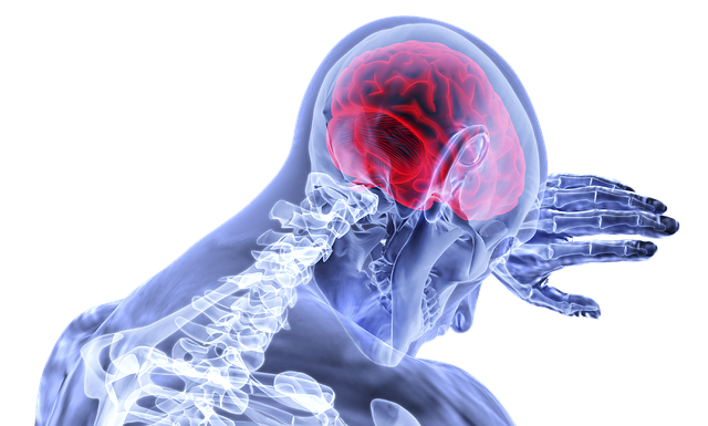 Read more about the article दिमाग की नस फटने का कारण BRAIN HEMORRHAGE की जानकारी