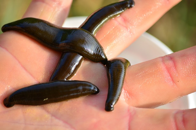 Read more about the article जोंक चिकित्सा LEECH THERAPY के फायदे, और दुष्प्रभाव